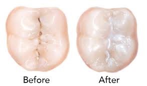 Preventive Dental Care Riverstone